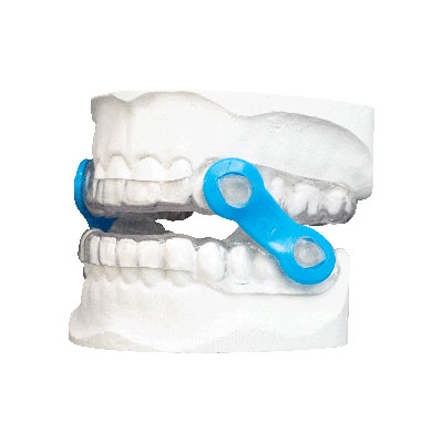 dental appliance for obstructive sleep apnea