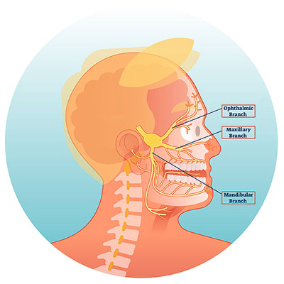 facial and jaw pain