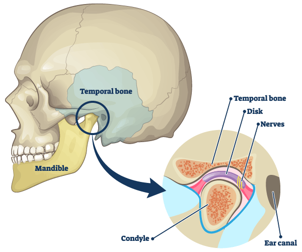 temporomandibular joint dysfunction